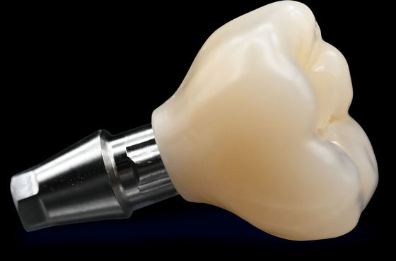 kopen CAD / CAM Implantatie Kroonbrug Hoge esthetiek Zirconia Kroon online manufacture