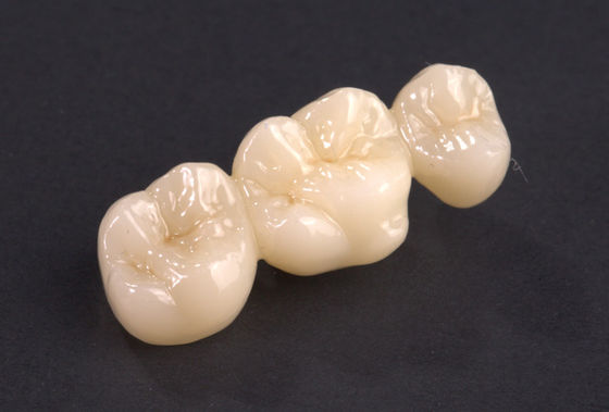 kopen Precise Fit Full Contour Zirconia Bridge Natuurlijke Zirconia Crown Bridge Hoge sterkte online manufacture