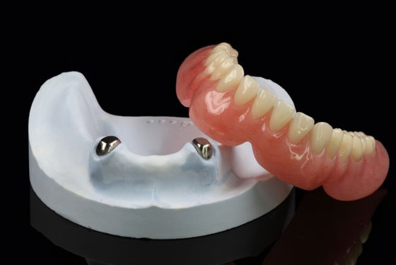 kopen Telescoop Verwijderbare Prothesen Precision Attachment Overprothese Arylic online manufacture