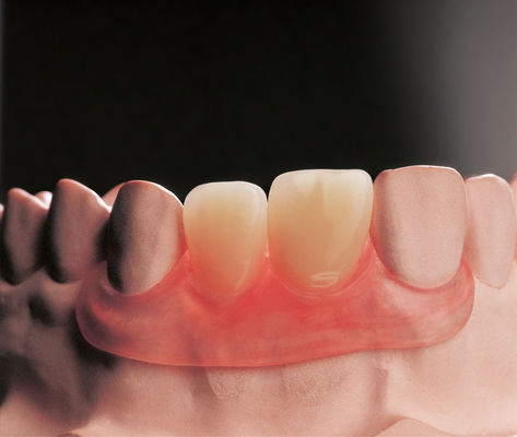kopen Flexible Flipper Verwijderbare Prothesen Klinische Verwijderbare Gedeeltelijke Prothese online manufacture