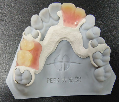 kopen Aanpasbaar Peek Afneembare Prothese Gedeeltelijk Frame slijtvastheid online manufacture