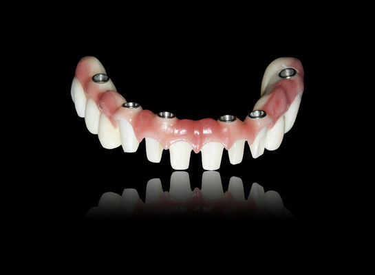 kopen ALL Op X Implantat Zirconia brug Implantat kroon brug Natuurlijke verschijning online manufacture