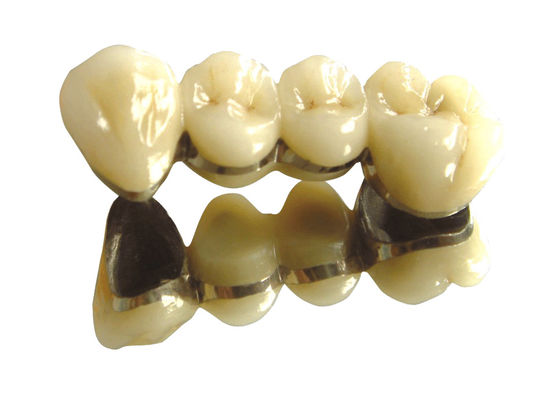 kopen Witte edel legering kroon en brug edelmetaal kroon en brug online manufacture