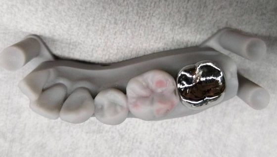 kopen Volledig metaal niet-edel kronenimplantat PFM kronen en brug professionele online manufacture