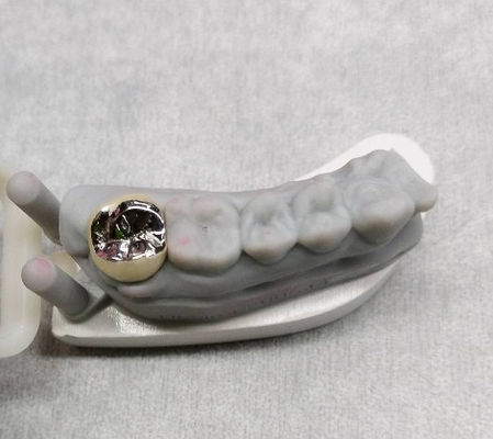 kopen Semi-Edelstaal metalen kroon en brugtand Tijdelijke kroon online manufacture