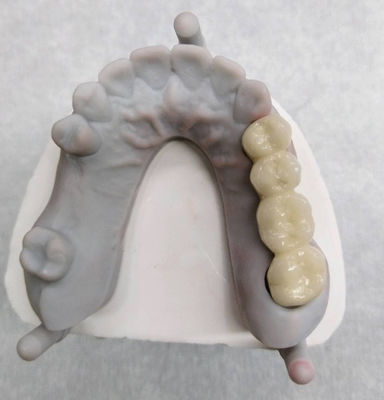 kopen Witte, hoognobele, edel legering, kroon en brug, accuraat en op maat. online manufacture