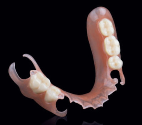 kopen Valplast Flexible Partial Removable Protheses Precision Attachment In Prosthodontie online manufacture