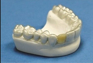 kopen Tandheelkundige stabiele tanden orthodontische retainer professionele heldere retainer online manufacture