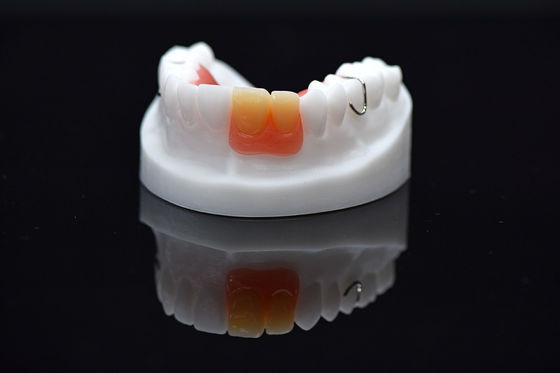 kopen Acrylische Flipper Verwijderbare Overprothese Op maat Verwijderbare Acrylische Prothese online manufacture