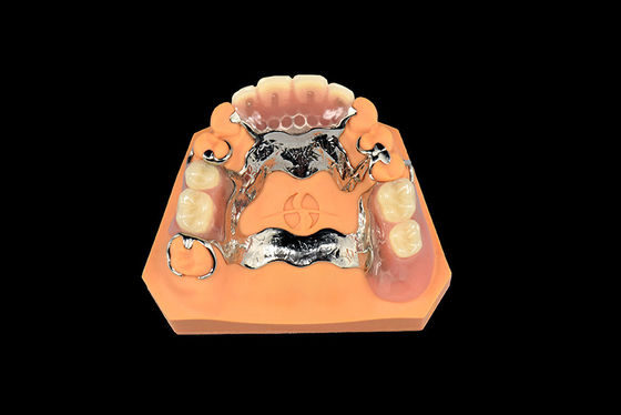 kopen Tandheelkundige implantaten Afneembare tandheelkunde Vitallium metaal gedeeltelijke tandheelkunde online manufacture