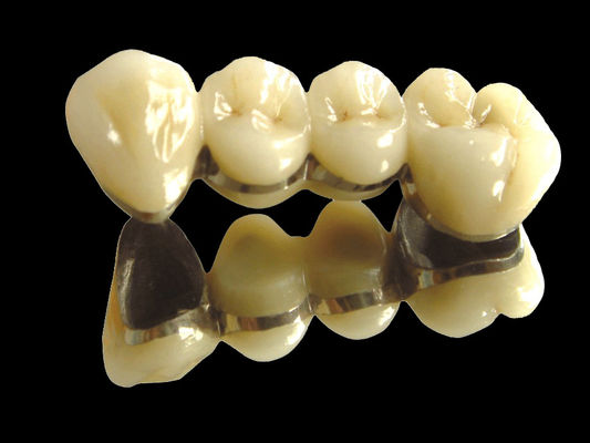 kopen Edelmetalen brug Implantat Kroonbrug slijtvast Op maat online manufacture
