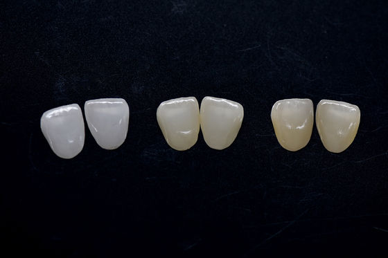 kopen Zeer esthetisch Zirconiafoelie Langdurig Zirconia Emaxfoelie online manufacture