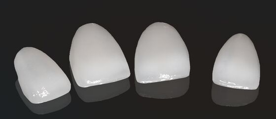 kopen Hoge esthetiek Composite Crown Onlay Veneer Aanpasbare grootte online manufacture