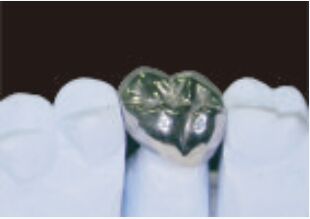 kopen Volle metalen kroon en brug Hoog nauwkeurige zilveren tijdelijke kroon online manufacture