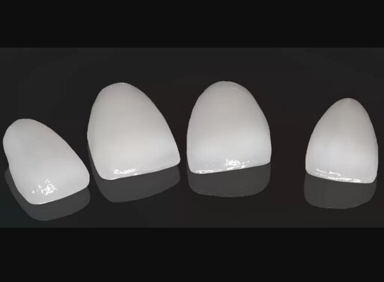 kopen Hoge esthetiek Composite Crown Onlay Veneer Aanpasbare grootte online manufacture