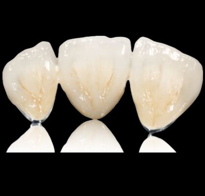 kopen Aanpasbare halffabricaten van edelmetaal en edelmetaal online manufacture