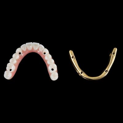 kopen Hybride tandheelkundige implantaten Hybride tandheelkundige prothese met titanium bar online manufacture