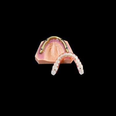 kopen Aanpasbare tandheelkundige zirconia brug over gefreesde implantaatbalk online manufacture