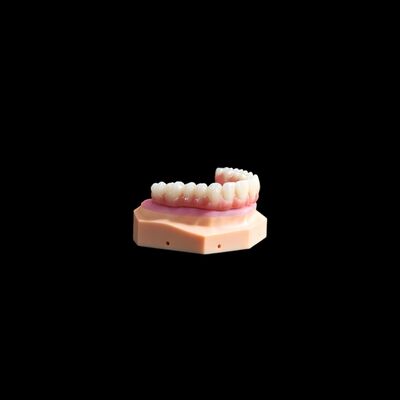 kopen Ti basis kroon implantaat Titanium kroon / brug aanpak met composiet online manufacture