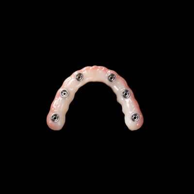 kopen Implantatie van tandheelkundige prothesen voor onmiddellijke belasting Lichte roze verwijderbare kunsttanden online manufacture