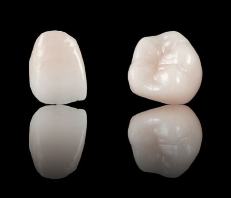 Hoge esthetiek Full Contour Crown Dental Zirconia Bridge CE en FDA goedkeuring