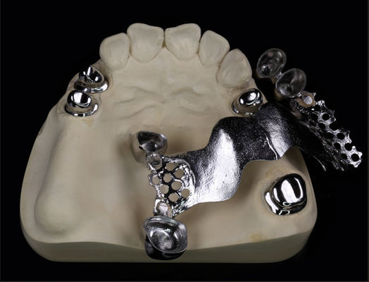 Afneembare kunsttandtelescoop met composiet en metalen raam