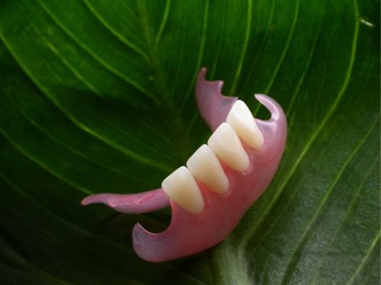 Duraflex Flexible Partieel Afneembare Esthetische Partieel Prothese