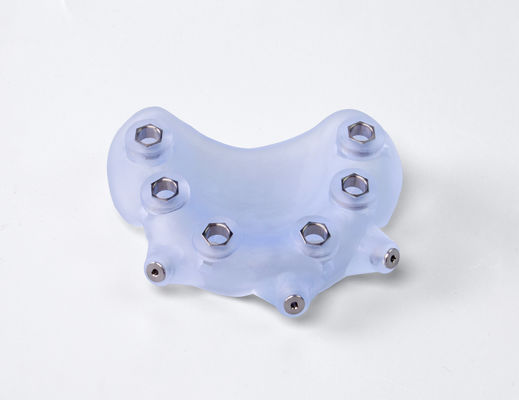Edel Implantat Chirurgische Gids Ergonomische 3D Geprinte Chirurgische Gids