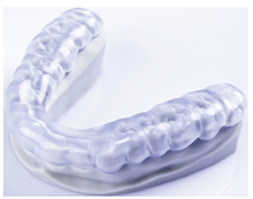 Transparante tandheelkundige zachte spalk 3D-geprinte orthodontieapparatuur