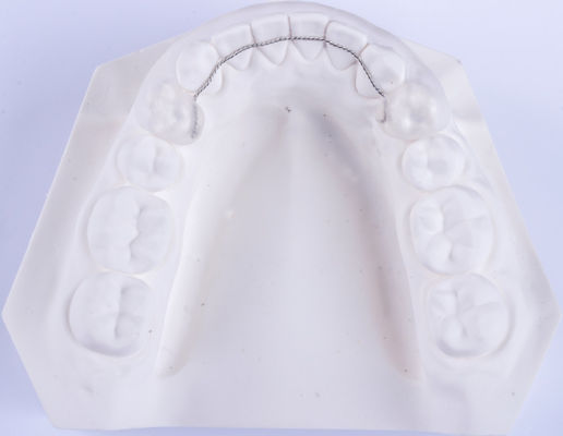 Niet-afneembare tongdraadhouder Orthodontie-houders voor het rechtzetten van tanden