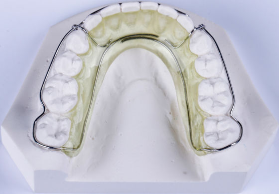 SS Nance-apparaat Orthodontie Roestvrij staal Nance-apparaat