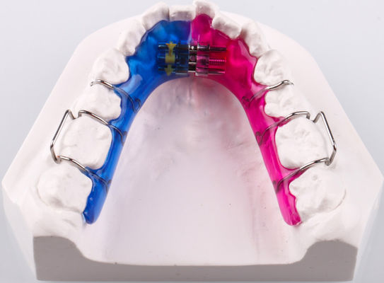 Verwijderbare tweerichtings tandvergrotingsapparaat voor orthodontie