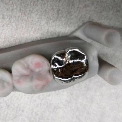 Volle metalen kroon en brug Hoog nauwkeurige zilveren tijdelijke kroon