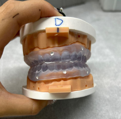 Aanpasbare 3D-geprinte gebitproeven.