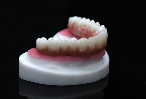 Full Arch Zirconia Hybrid Bridge Zirconia Crown Bridge Op maat gemaakt