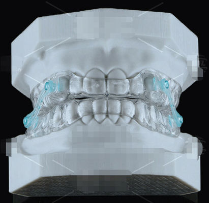 Transparante Erkodent Silensor Orthodontieapparaat Anti-snurken mondstuk