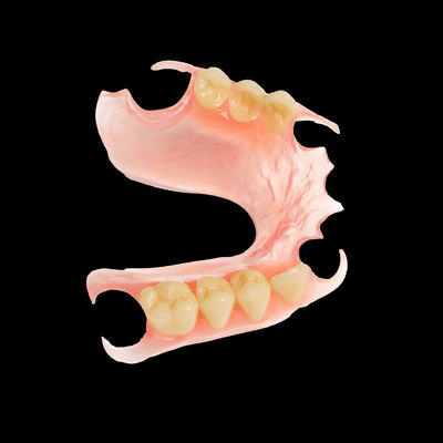 Roze TCS Flexible Partials Uitstekende retentie TCS Flexible Prothese