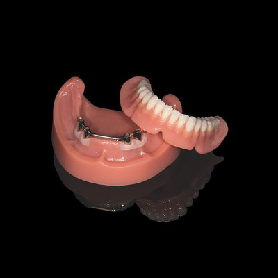 Roze titaniumbalk verwijderbare gebit met acrylprothese afwerking