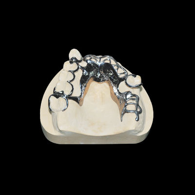 Hoge nauwkeurigheid Vitallium Frame Afneembare tandprothese Klasse 2