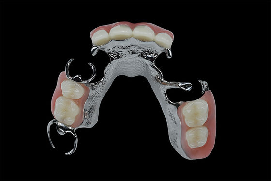 Aanpasbare verwijderbare gebitten Titanium frame Tandheelkundig metaal frame